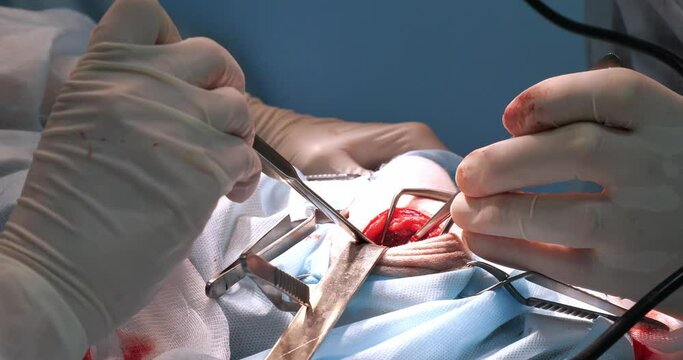 A veterinary surgeon cuts out part of the animal's spine to get to the destroyed intervertebral disc. A pet with a spinal disorder undergoes surgery at a veterinary clinic. Spinal surgery in pets.