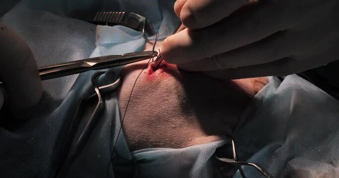 A veterinary surgeon suturing a pet's surgical wound after completing spinal surgery. The end of a difficult and complex operation to restore the injured spine of a pet.