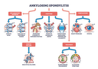 Ankylosing spondylitis as arthritis symptoms or complications outline diagram. Labeled educational medical scheme with spine inflammation illness and condition vector illustration. Back bone disease.