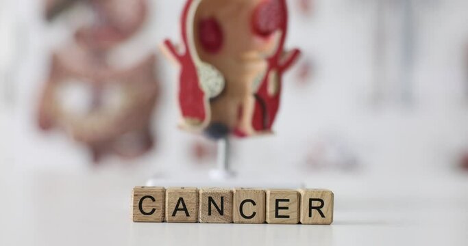 Word cancer on wooden cubes on background of anatomical model of rectum 4k movie. Diagnosis and treatment of cancer of rectum and large intestine concept