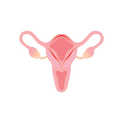 Endometritis Scientific Design. Vector Illustration.