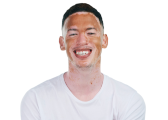 Skincare, portrait or happy black man with vitiligo on isolated, transparent or png background. Smile, face or male model with wellness, treatment or facial, results or hypopigmentation beauty