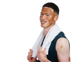 Happy man with vitiligo, portrait and towel in fitness for workout isolated on a transparent PNG background. Male person or model smile with skin pigmentation in cardio, intense exercise or training