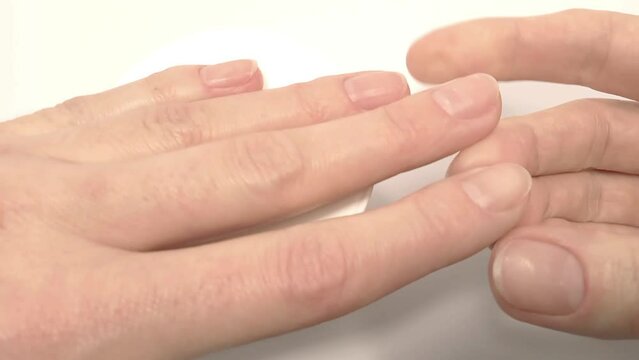 White spots on the fingernails, symptoms of iron deficiency anemia. Examination and diagnosis of the nail disease