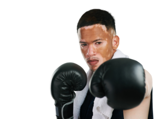 Man with vitiligo and portrait and boxing gloves for fight, self defense or training isolated on transparent PNG background. Face of person, boxer or fighter with skin pigmentation in sports fitness