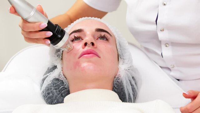 Fractional microneedle RF lifting procedure in beauty clinic. Hardware cosmetology. Close up. Beautician making facial rejuvenation treatment. Skincare anti-age concept.