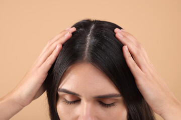 Woman examining her hair and scalp on beige background, closeup. Dandruff problem