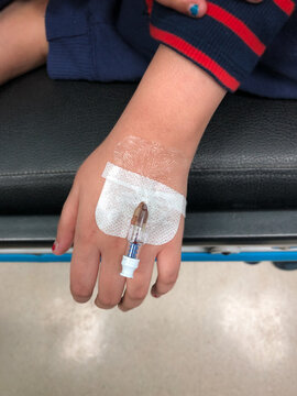 Cannula on the hand of a young girl