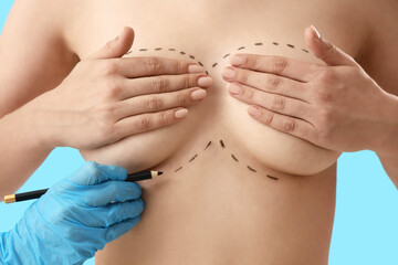 Plastic surgeon drawing marks on female breast before operation against blue background, closeup