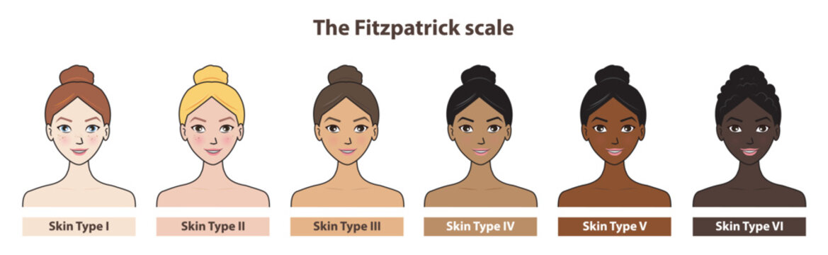 Fitzpatrick skin tone phototype with cute cartoon character vector isolated on white background. Diagram of ethnicity skin tone scale phototype melanin and hair color melanin. The Fitzpatrick scale.