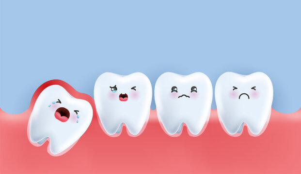 Wisdom teeth under the gums cause pain in the mouth. Impacted wisdom tooth character pushing adjacent teeth causing inflammation, toothache, gum pain. vector design.