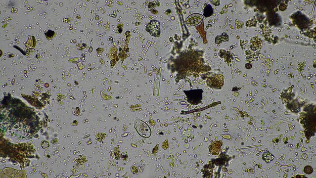 soil microorganisms under the microscope, including, fungi hyphae