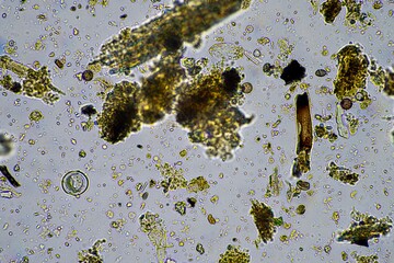 human parasite. gut intestinal infection disease. microorganism infection in hospital