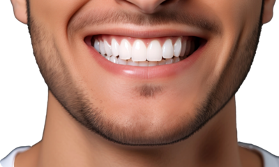 Young man with beautiful smile . Teeth whitening isolated on transparent background