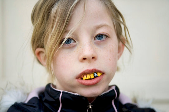 Young girl models fake bad teeth; Lincoln, Nebraska, United States of America