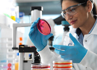 Scientist examining cultures growing in petri dishes using a inverted microscope in the laboratory