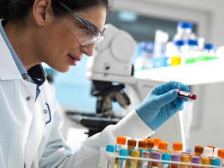 Lab technician preparing a variety of human samples for medical testing in the laboratory