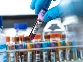 Male scientist holding blood sample vial in laboratory