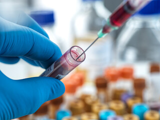 Biomedical technician testing blood sample at laboratory