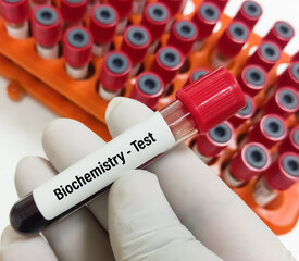 Scientist holding a blood sample for Biochemistry test in laboratory.
