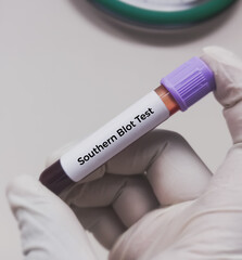 Blood sample for FSHD1 Southern Blot Test, deletions on chromosome 4q35 in patients with...