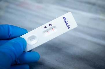 Blood sample of patient positive tested for malaria by rapid diagnostic test.