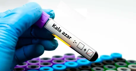 Photo sur Plexiglas Atlantic Ocean Road Blood sample of patient positive tested for Kala azar.
