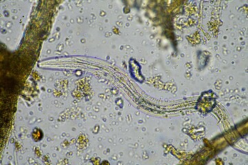 soil microorganisms including nematode, microarthropods, micro arthropod, tardigrade, and rotifers...
