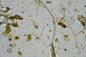 fungus and fungal hyphae in a soil sample on a farm, microorganisms and soil biology, fungi in the...
