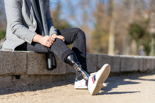 Young man missing a leg putting on a prosthetic leg