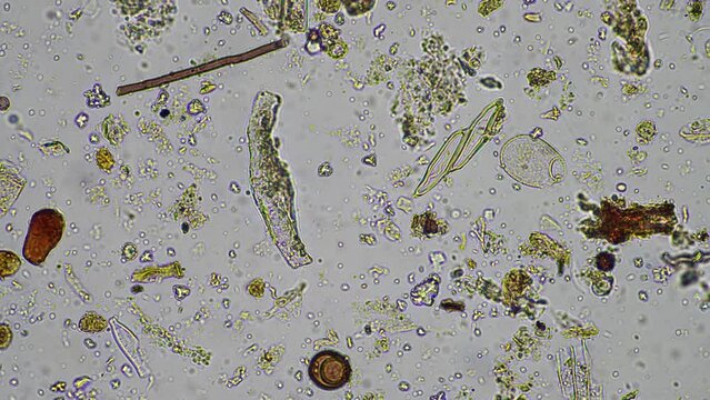 Soil microorganisms in a compost sample including bacteria, testate amoeba, flagellates. regenerative agricultural farm. Soil testing agriculture agronomy done for farmers for carbon sequestration