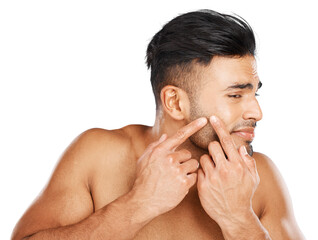 Man, face and squeeze acne for skincare breakout, dermatology and scar isolated on transparent png...