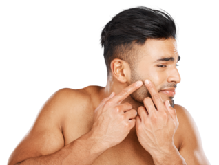 Man, face and squeeze acne for skincare breakout, dermatology and scar isolated on transparent png background. Indian guy check facial beauty, press sensitive pimple and stress to scratch blackhead