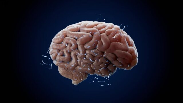 Brain mind thinking getting ideas sparkling with electricity morphing. Electric arcing 3d animation. Psychology health, ADHD cognition, migraine, depression or imagination. Ai, artificial intelligence