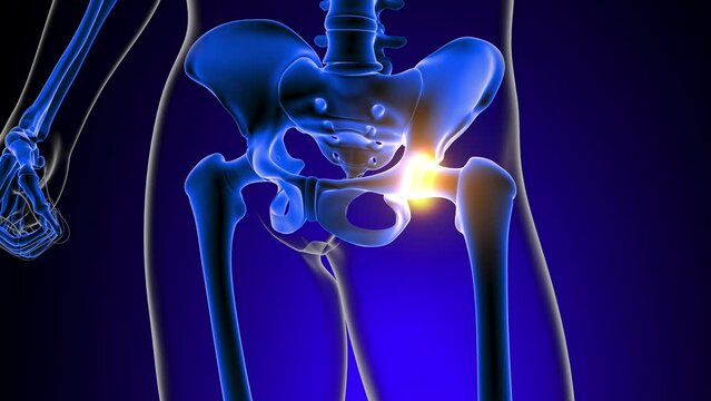 Hip joint pain Anatomy For Medical Concept 3D