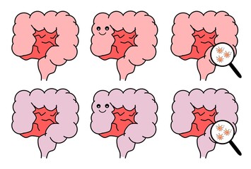健康な大腸と病気を抱えた大腸