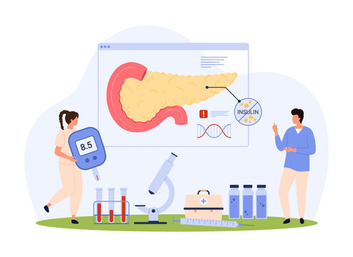 Diabetes type 1 and 2, diagnosis of endocrinology vector illustration. Cartoon tiny people research pathology of pancreas and receptors to insulin on infographic anatomy chart, holding glucometer