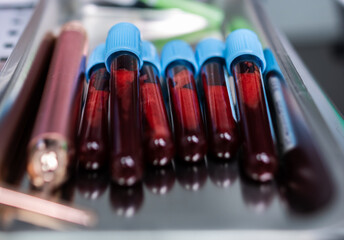 Test tubes filled with blood after blood collection for posterior analysis.