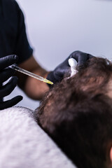 Close-up photo of a doctor's hands injecting stem cells into a patient's head. PRP Therapy
