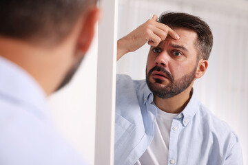 Confused man with skin problem looking at mirror indoors