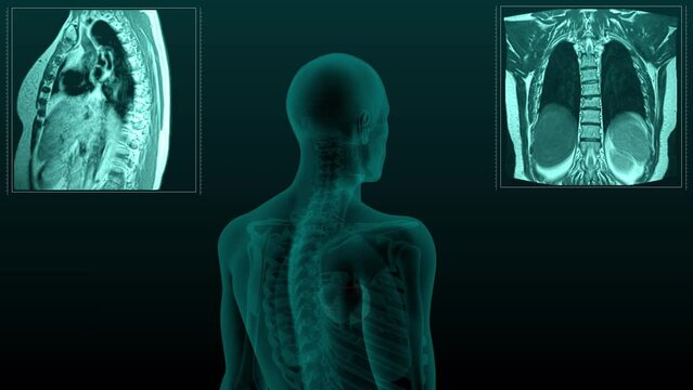 A medically anatomically correct Magnetic resonance scan of the cardiovascular system Coronary arteries. 3D rendering of a chest X-ray scan.