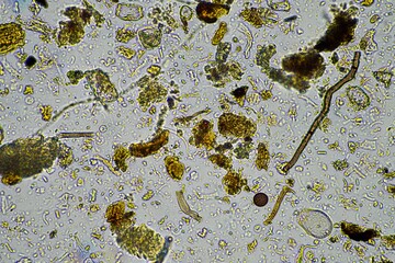 soil sample containing soil biology, with bacteria, fungi, amoeba, flagellate, and arcella, on a...