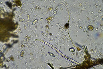 forest soil sample under the microscope looking at microorganisms and fungi