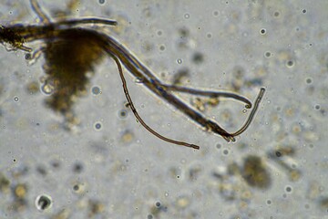 microorganisms and soil biology, with nematodes and fungi under the microscope. in a soil and...