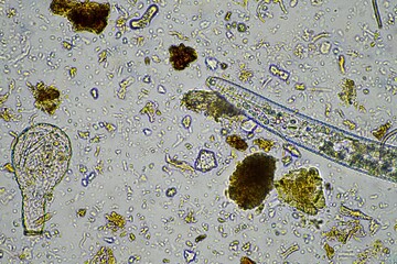 microorganisms and soil biology, with nematodes and fungi under the microscope. in a soil and...