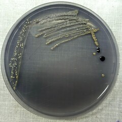 Aniline Blue, Agrobacterium