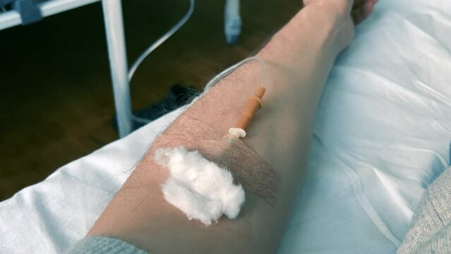 POV of a man's arm with an IV needle in the median cubital vein (antecubital vein). A person is receiving intravenous fluid. Intravenous injections, medical care in a clinic. Recovering patient