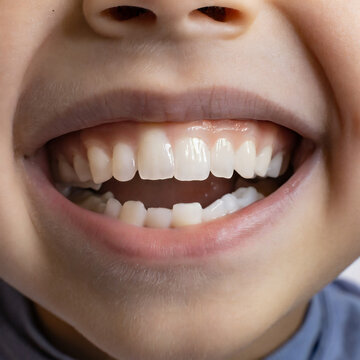 denti bocca bambino dentista 