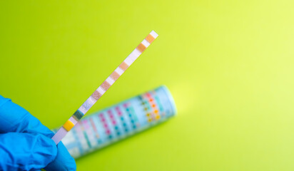 reagent drug test preventive control ph lamina