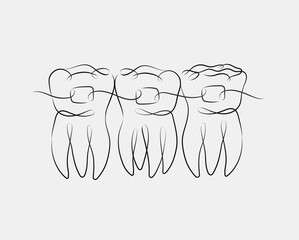 Teeth with braces illustration drawing in linear style on white background
